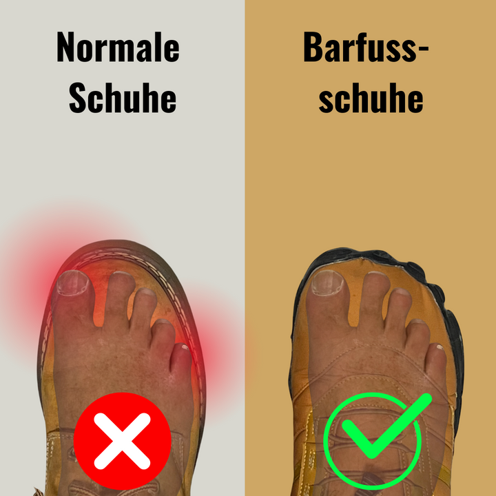 Yeti-Barfussschuh